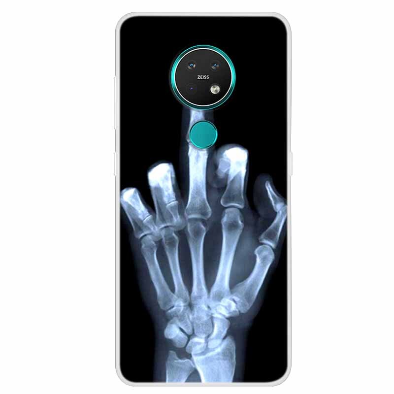 Deksel til Nokia 7.2 deksel 6.2 C20 C30 silikondeksel med motiv For Nokia 6.2 deksel Bumper Nokia X20
