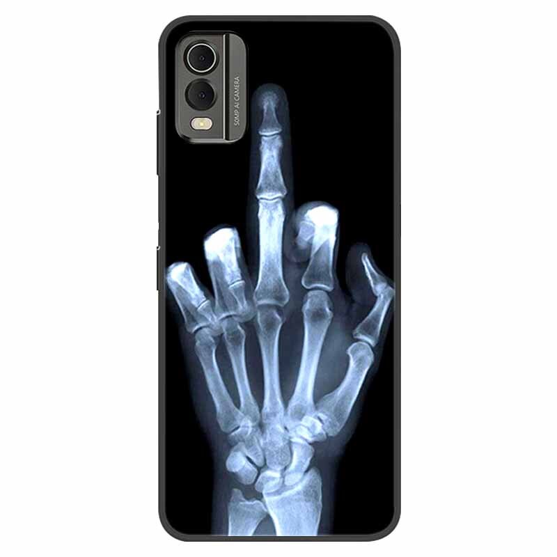 Deksel til Nokia C32 deksel støtsikkert silikondeksel For Nokia C32 C 32 Phone deksel NokiaC32 med motiv Shells